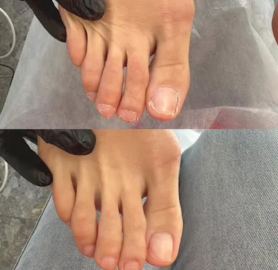 Podologia Zawiercie Wókół Stóp